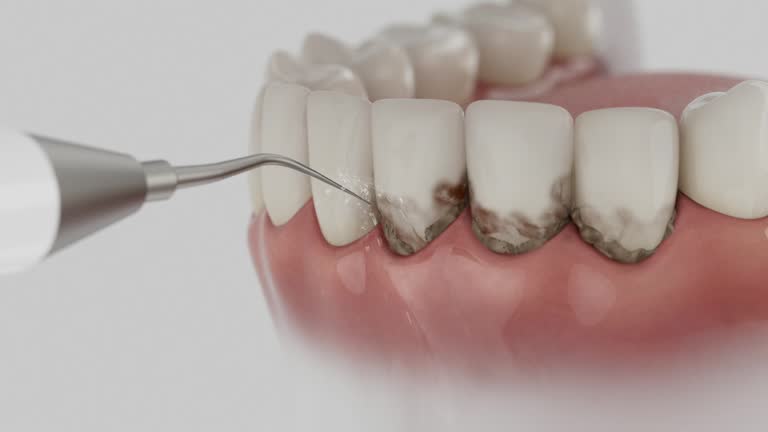 Trusted Root Canal Treatment service in L'Anse, MI - Dentist Open Now